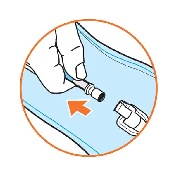 ניקוי שלוקר שורש